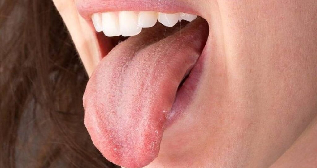 dildeki bu isaret buyuk tehlikenin habercisi xYya1pwh