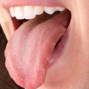 dildeki bu isaret buyuk tehlikenin habercisi xYya1pwh