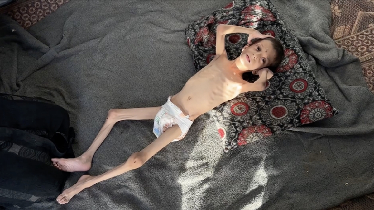 israilin kitliga surukledigi 10 yasindaki nafiz kemik yiginina donustu yQnYeNWR