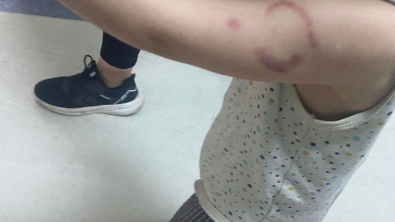 kreste kan donduran olay ogretmen cocugun kolunu isirdi VMKEIexL.jpg